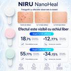 Patch anti-acnee electronic NIRU NanoHeal